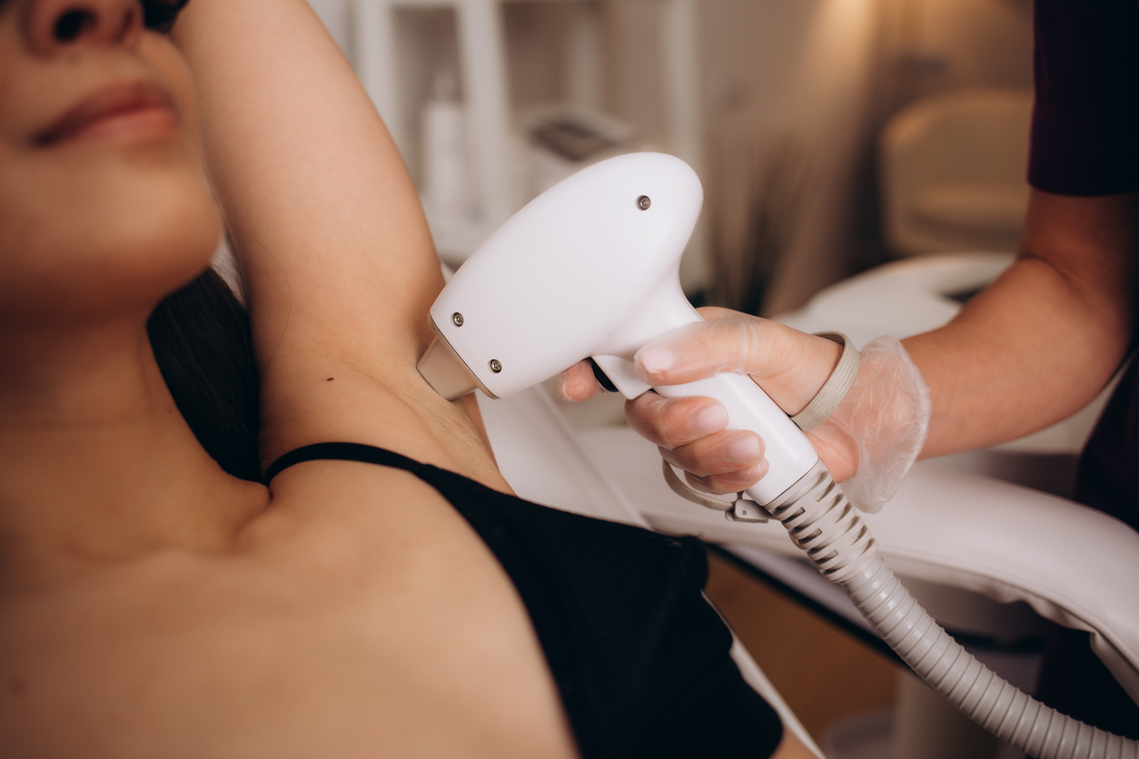 Laser Hair Removal in Frisco Texas